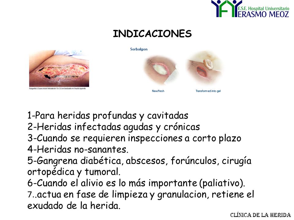 INDICACIONES 1-Para heridas profundas y cavitadas 2-Heridas infectadas agudas y crónicas 3-Cuando se requieren inspecciones a corto plazo 4-Heridas no-sanantes. 5-Gangrena diabética, abscesos, forúnculos, cirugía ortopédica y tumoral. 6-Cuando el alivio es lo más importante (paliativo). 7..actua en fase de limpieza y granulacion, retiene el exudado de la herida.