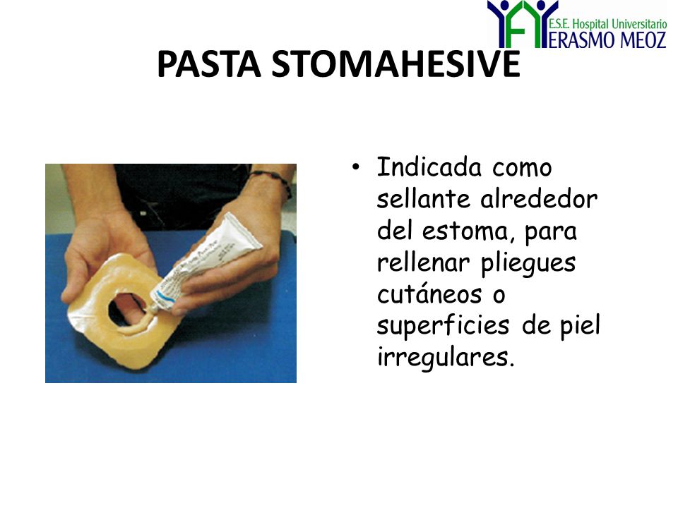 PASTA STOMAHESIVE Indicada como sellante alrededor del estoma, para rellenar pliegues cutáneos o superficies de piel irregulares.