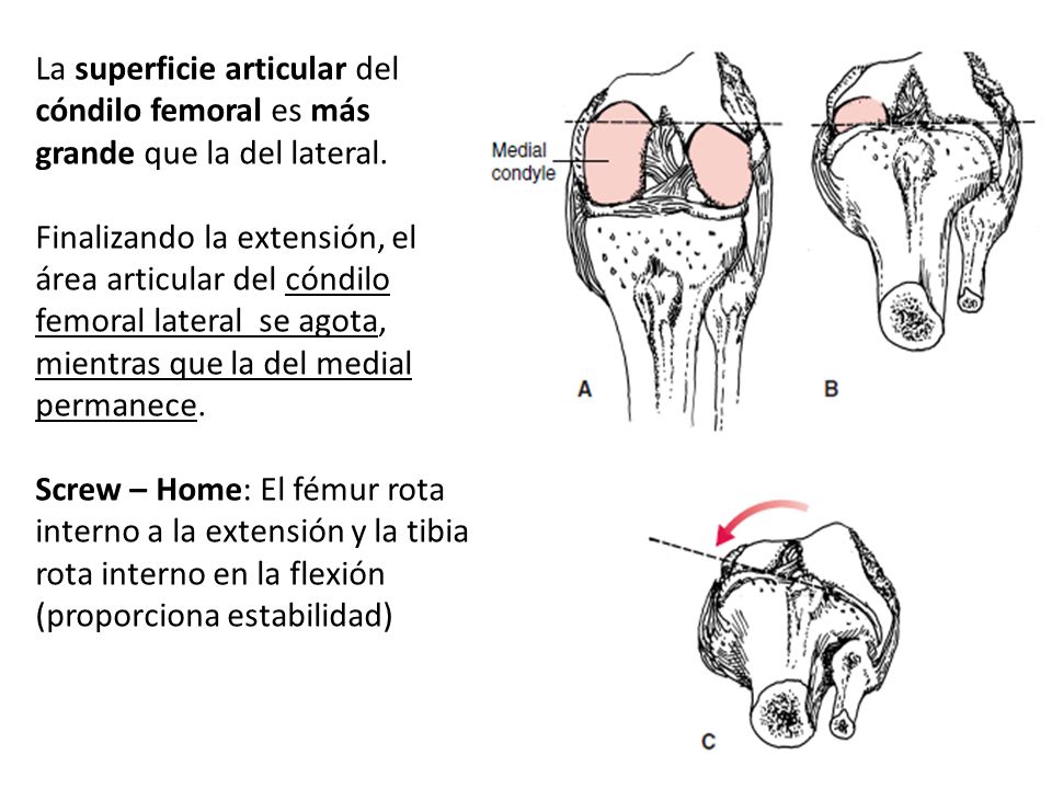 La superficie articular del cóndilo femoral es más grande que la del lateral.