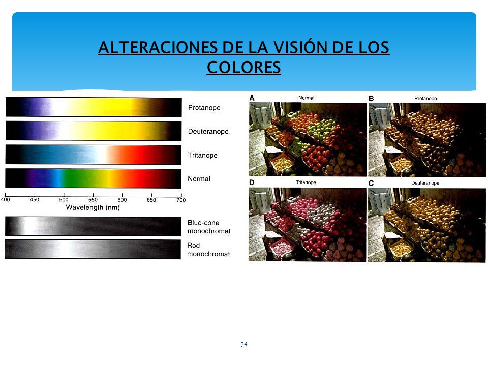 ALTERACIONES DE LA VISIÓN DE LOS COLORES
