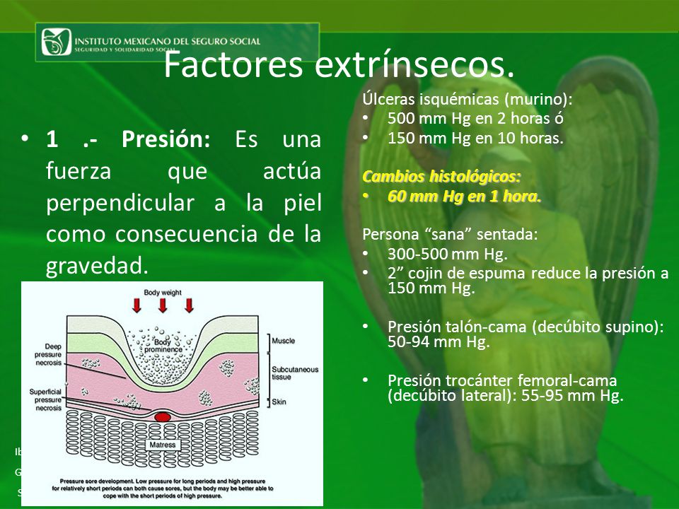 Factores extrínsecos. Úlceras isquémicas (murino): 500 mm Hg en 2 horas ó. 150 mm Hg en 10 horas.