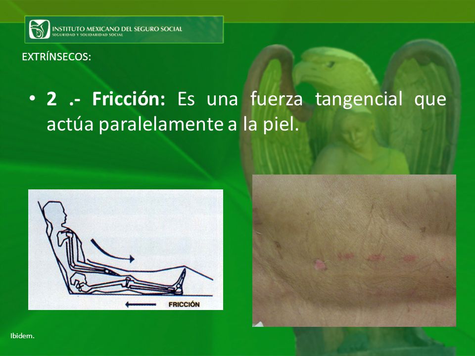 EXTRÍNSECOS: 2 .- Fricción: Es una fuerza tangencial que actúa paralelamente a la piel. Ibidem.