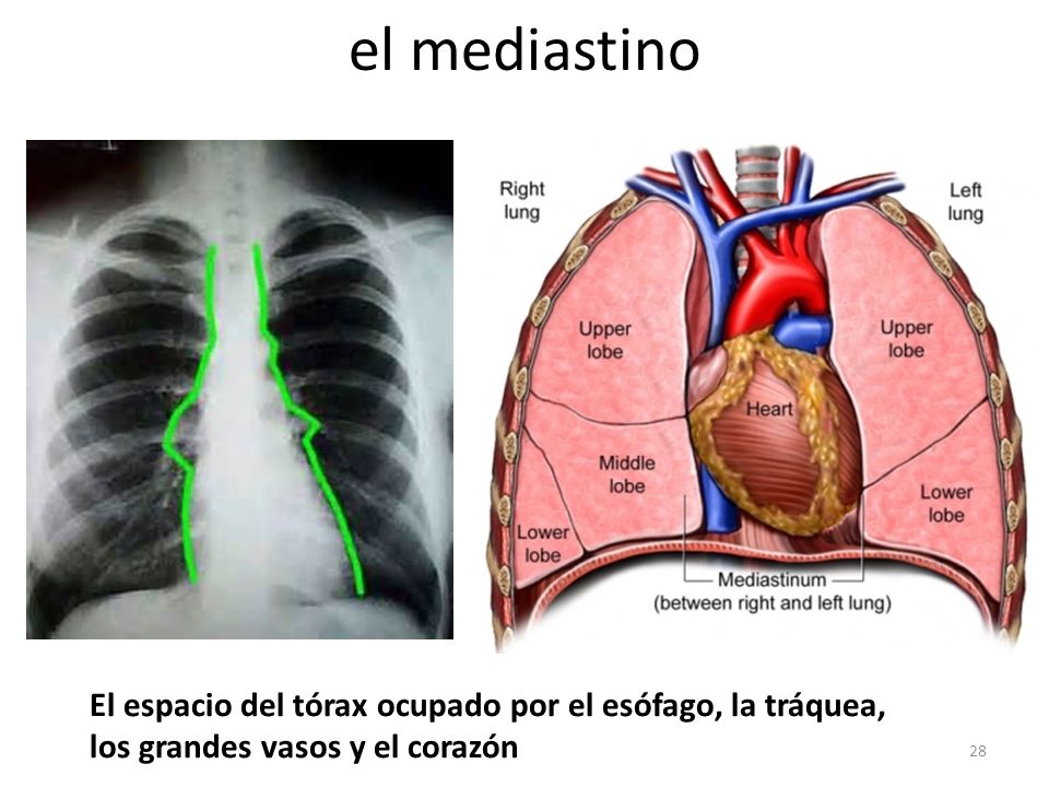 el mediastino El espacio del tórax ocupado por el esófago, la tráquea, los grandes vasos y el corazón.