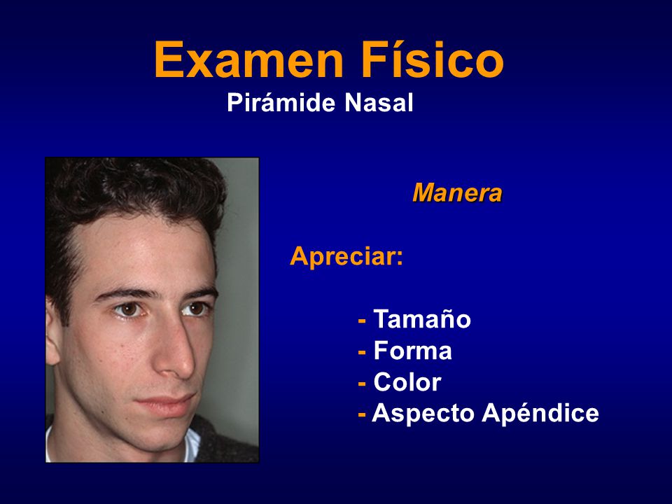 Examen Físico Pirámide Nasal Manera Apreciar: - Tamaño - Forma - Color
