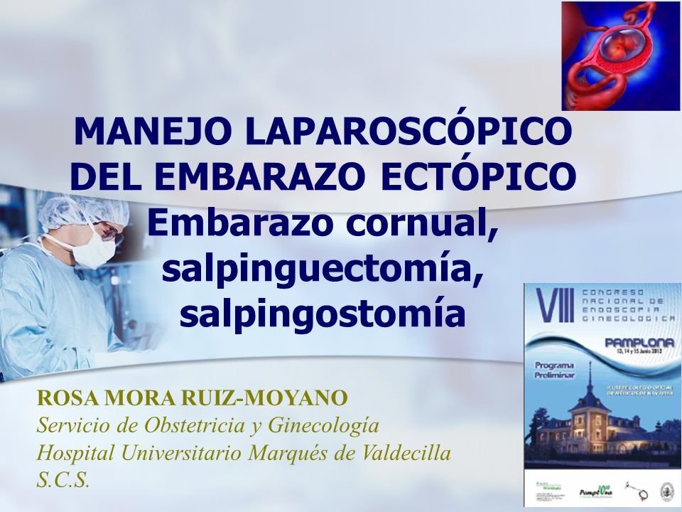 MANEJO LAPAROSCÓPICO DEL EMBARAZO ECTÓPICO Embarazo cornual, salpinguectomía, salpingostomía