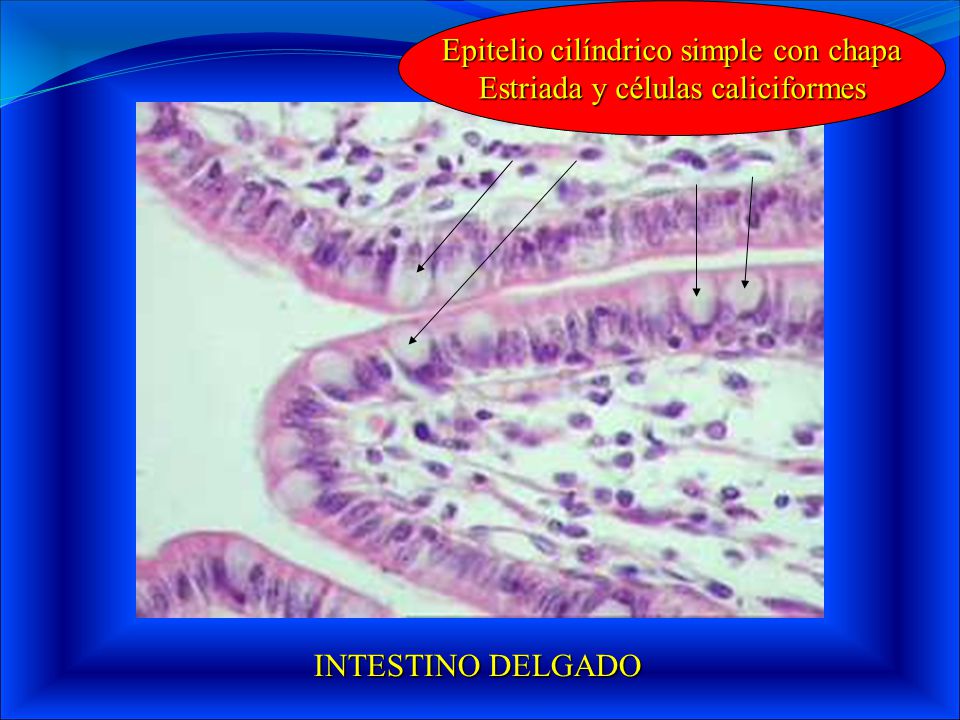 Epitelio cilíndrico simple con chapa Estriada y células caliciformes