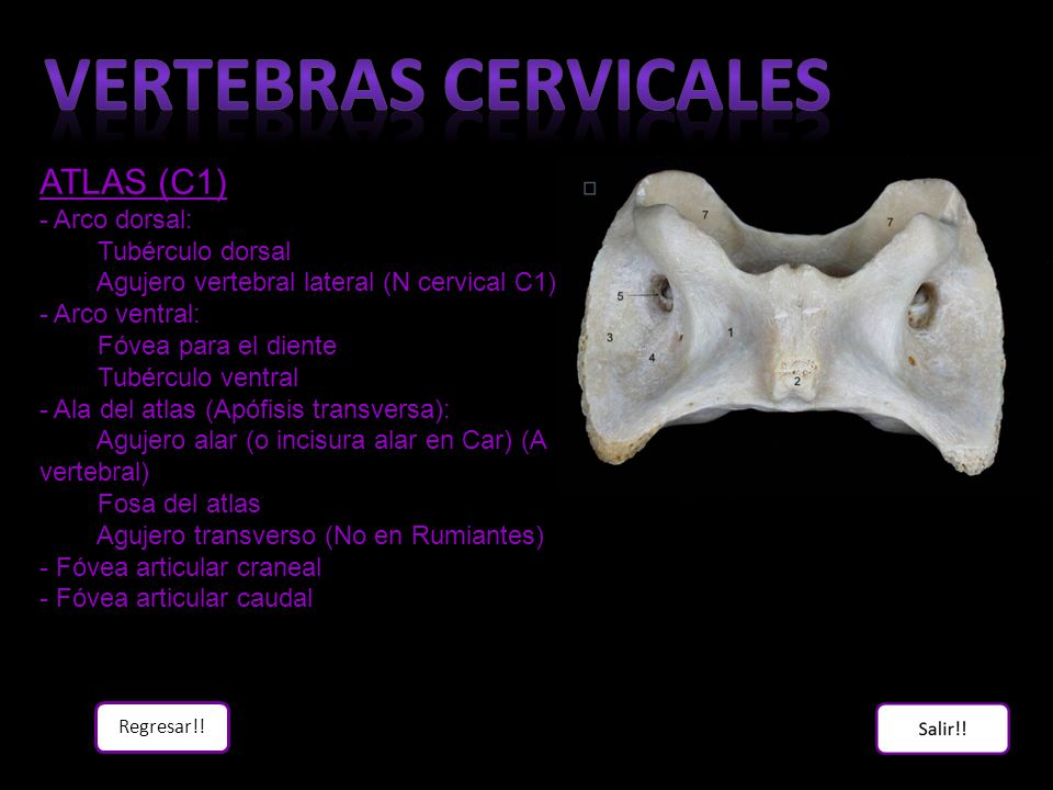 Vertebras cervicales ATLAS (C1) - Arco dorsal: Tubérculo dorsal