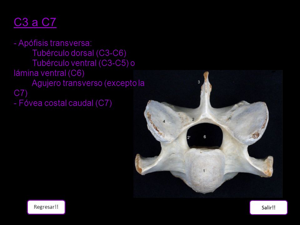 C3 a C7 - Apófisis transversa: Tubérculo dorsal (C3-C6)