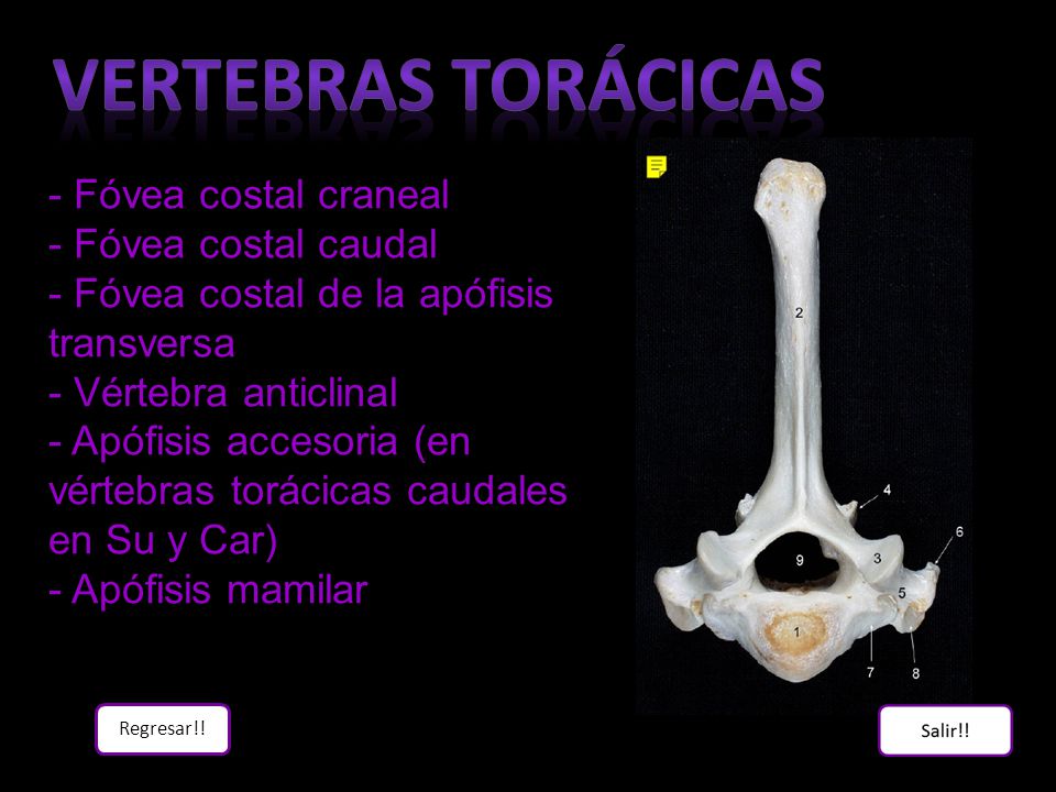 Vertebras torácicas - Fóvea costal craneal - Fóvea costal caudal