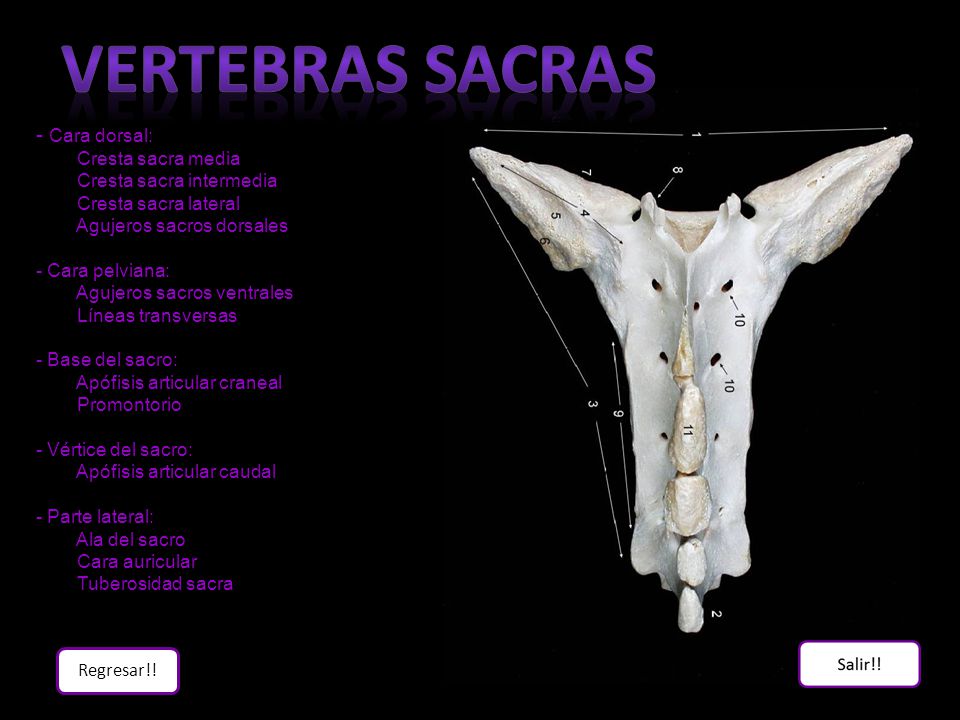 Vertebras sacras - Cara dorsal: Cresta sacra media