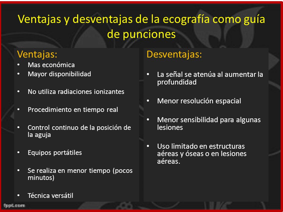 Ventajas y desventajas de la ecografía como guía de punciones