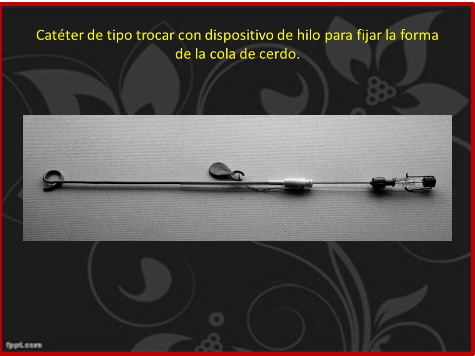 Catéter de tipo trocar con dispositivo de hilo para fijar la forma de la cola de cerdo.