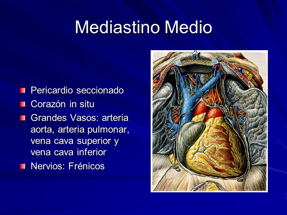Mediastino Medio Pericardio seccionado Corazón in situ