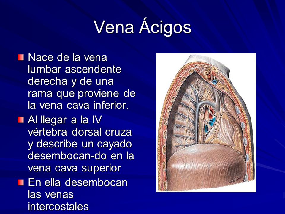 Vena Ácigos Nace de la vena lumbar ascendente derecha y de una rama que proviene de la vena cava inferior.