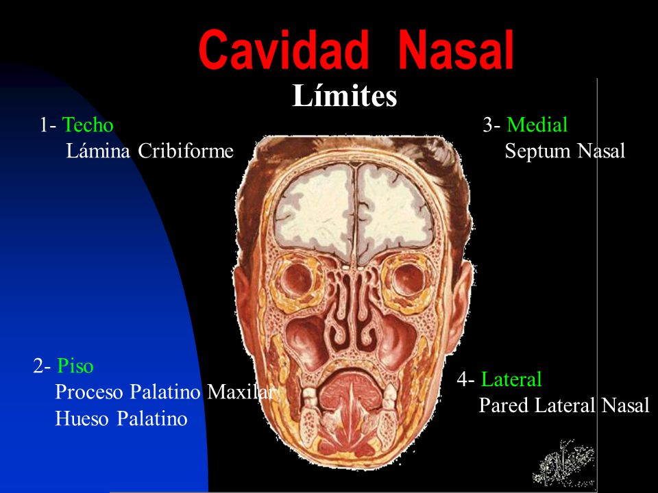 Cavidad Nasal Límites 1- Techo Lámina Cribiforme 3- Medial