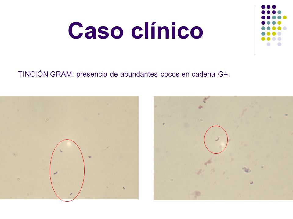 Caso clínico TINCIÓN GRAM: presencia de abundantes cocos en cadena G+.