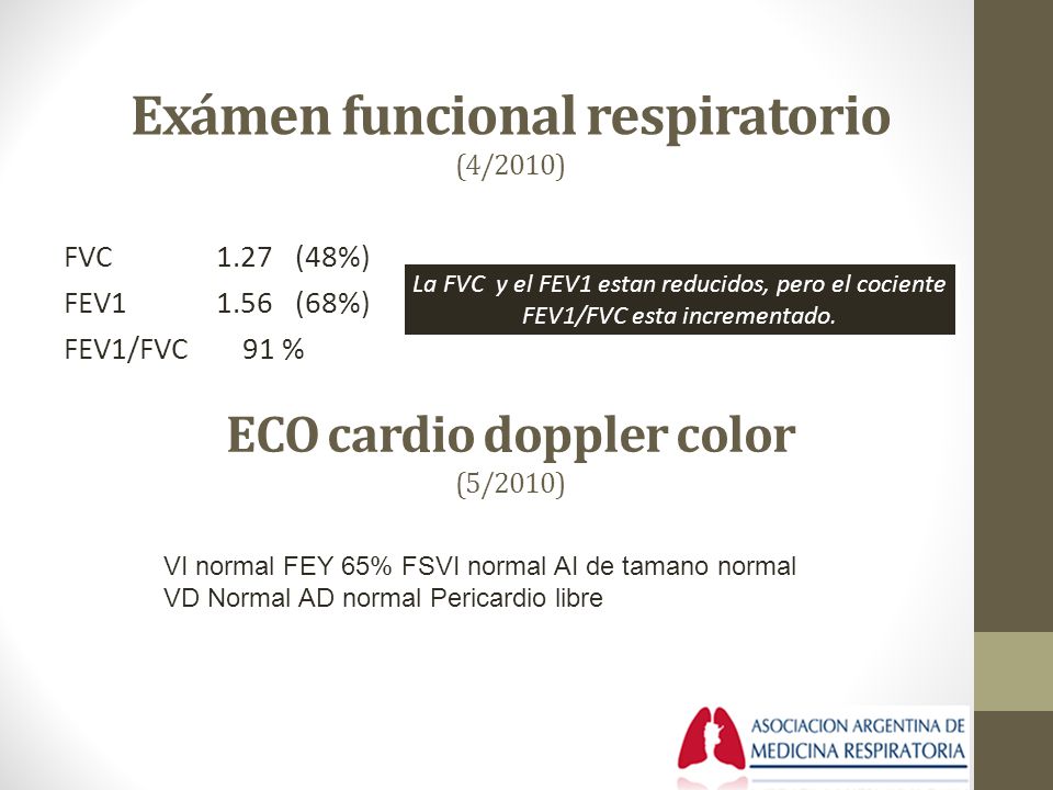 ECO cardio doppler color (5/2010)