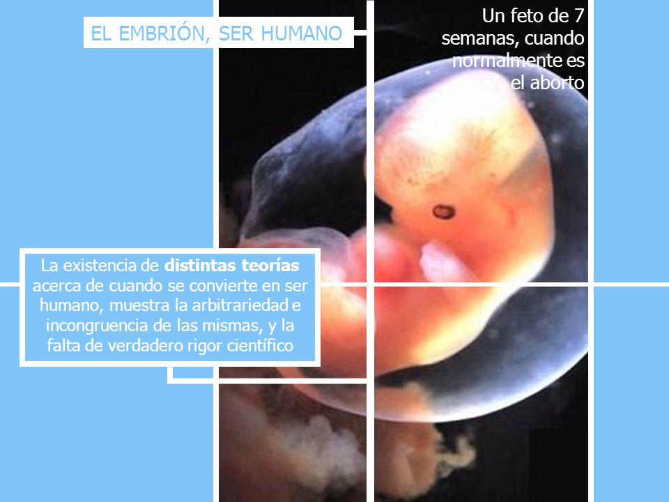 Un feto de 7 semanas, cuando normalmente es el aborto