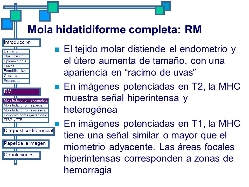 Mola hidatidiforme completa: RM