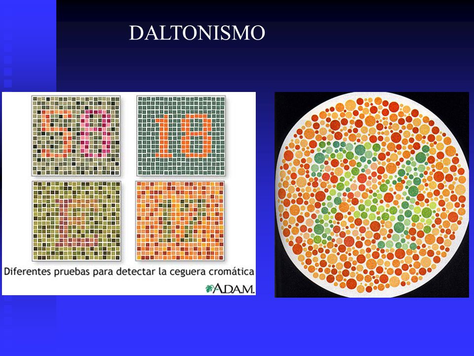 DALTONISMO las respuestas correctas son: 58, 18, E, 17 y 74