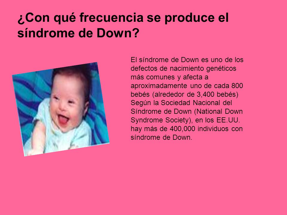 ¿Con qué frecuencia se produce el síndrome de Down