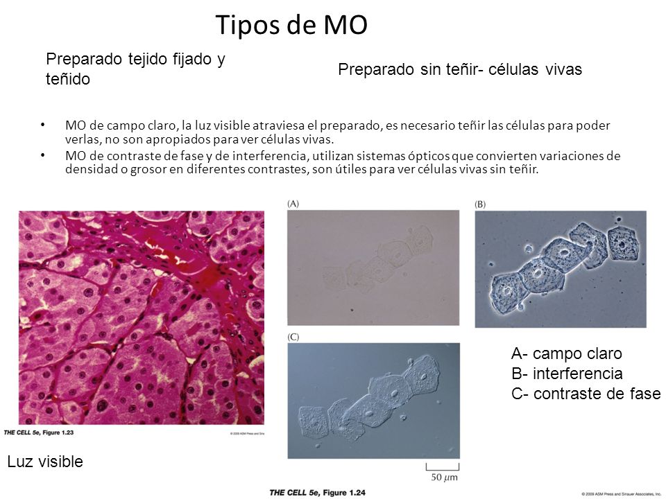 Tipos de MO Preparado tejido fijado y teñido