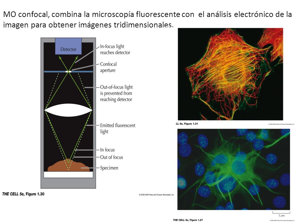 MO confocal, combina la microscopía fluorescente con el análisis electrónico de la imagen para obtener imágenes tridimensionales.