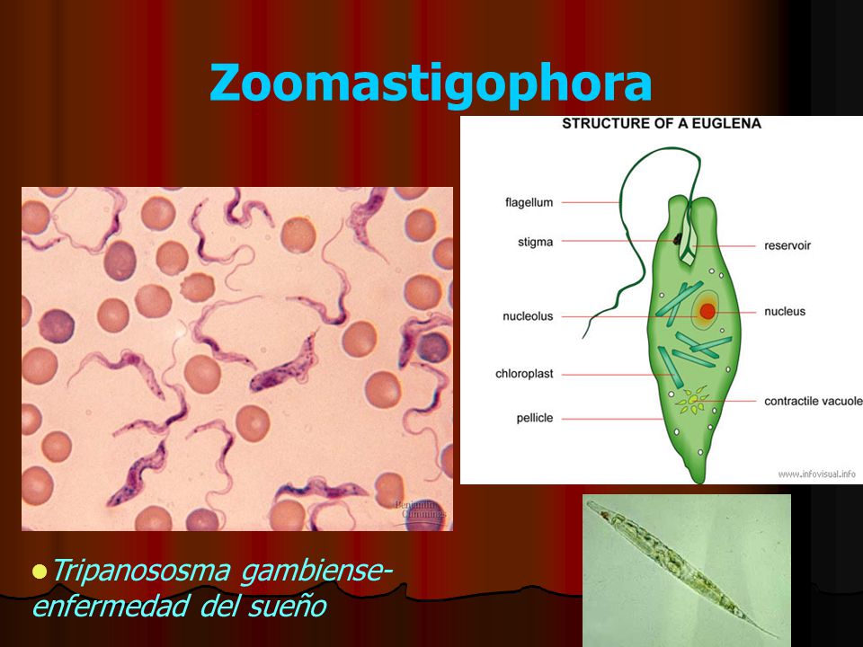 Zoomastigophora Tripanososma gambiense- enfermedad del sueño