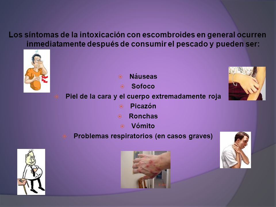 Los síntomas de la intoxicación con escombroides en general ocurren inmediatamente después de consumir el pescado y pueden ser: