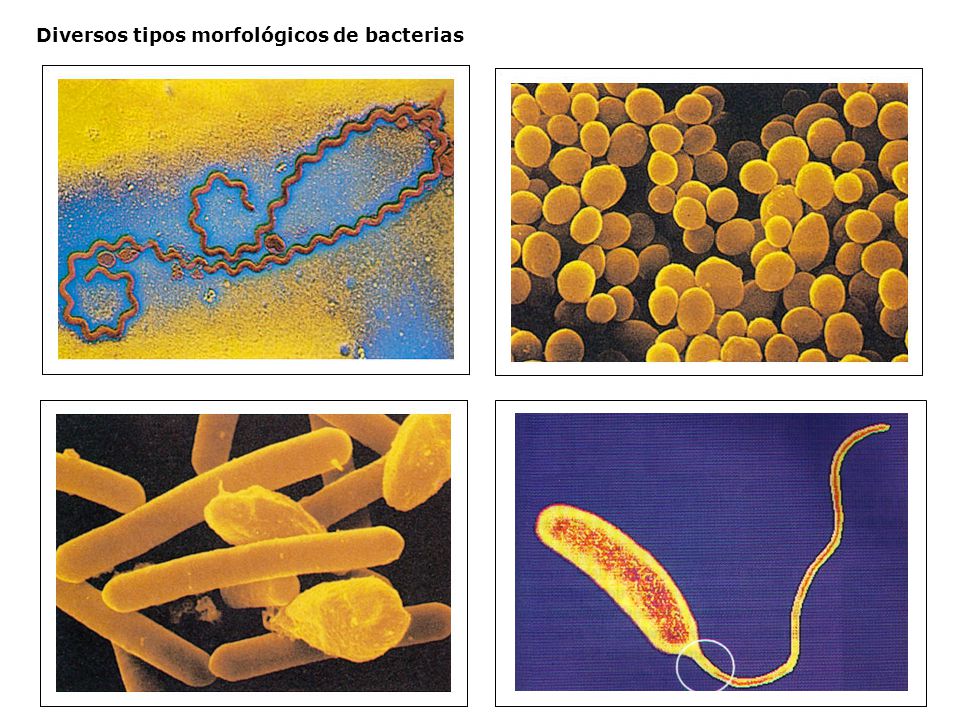 Diversos tipos morfológicos de bacterias