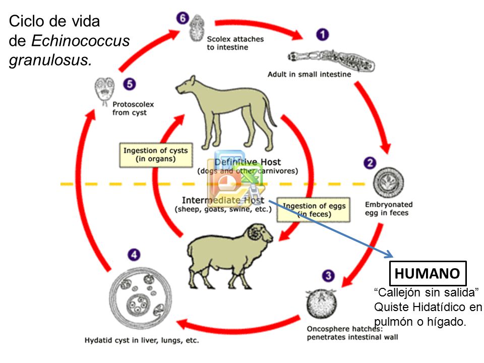 Ciclo de vida de Echinococcus granulosus. HUMANO Callejón sin salida