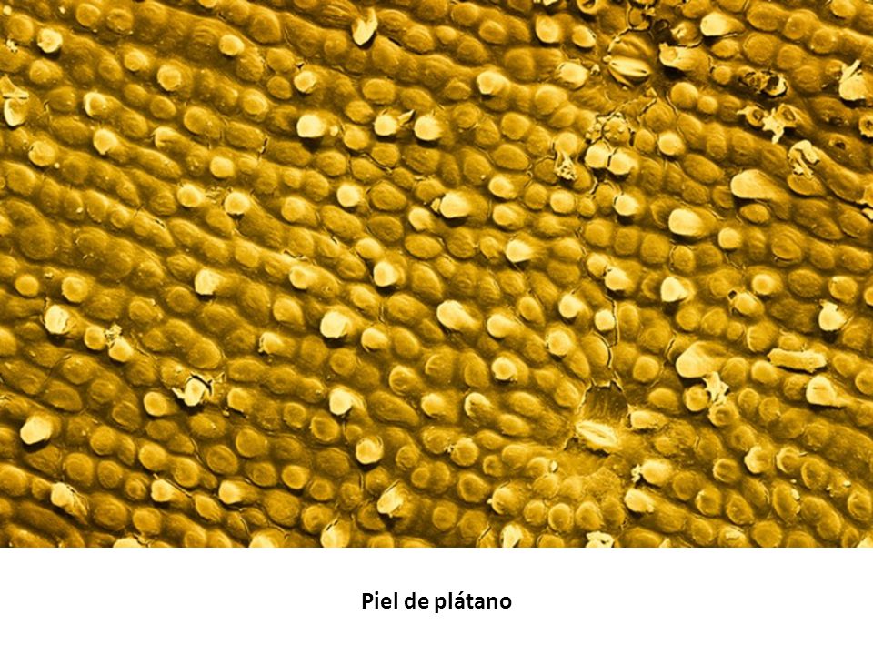 Piel de plátano