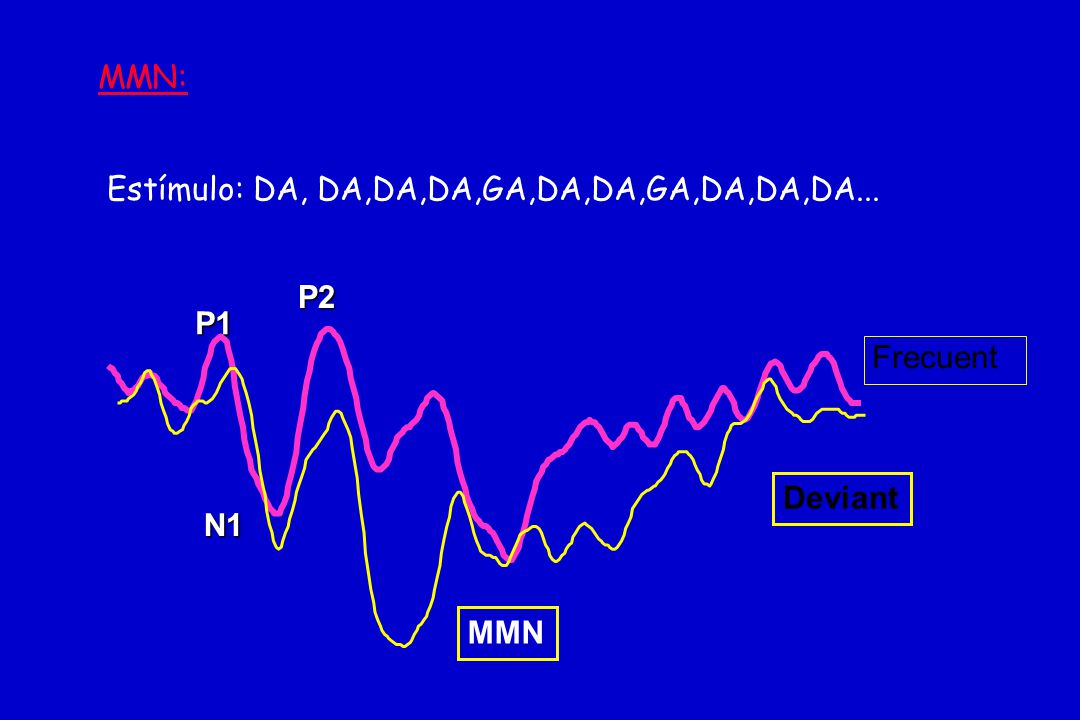 MMN: Estímulo: DA, DA,DA,DA,GA,DA,DA,GA,DA,DA,DA... P1 N1 P2 Frecuent MMN Deviant