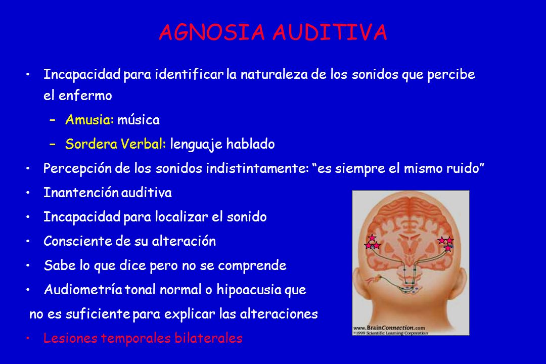 AGNOSIA AUDITIVA Incapacidad para identificar la naturaleza de los sonidos que percibe el enfermo. Amusia: música.