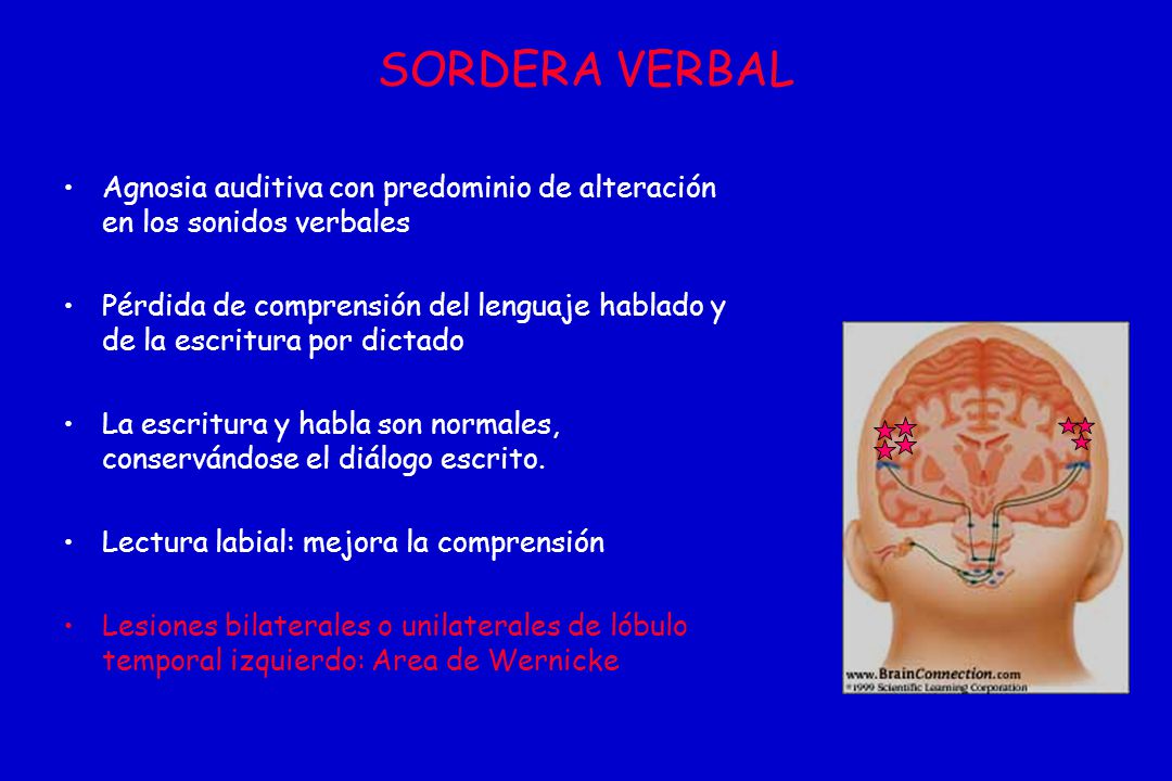 SORDERA VERBAL Agnosia auditiva con predominio de alteración en los sonidos verbales.