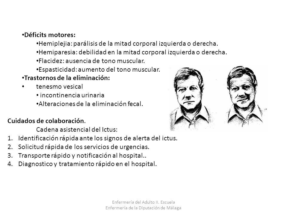 Hemiplejia: parálisis de la mitad corporal izquierda o derecha.