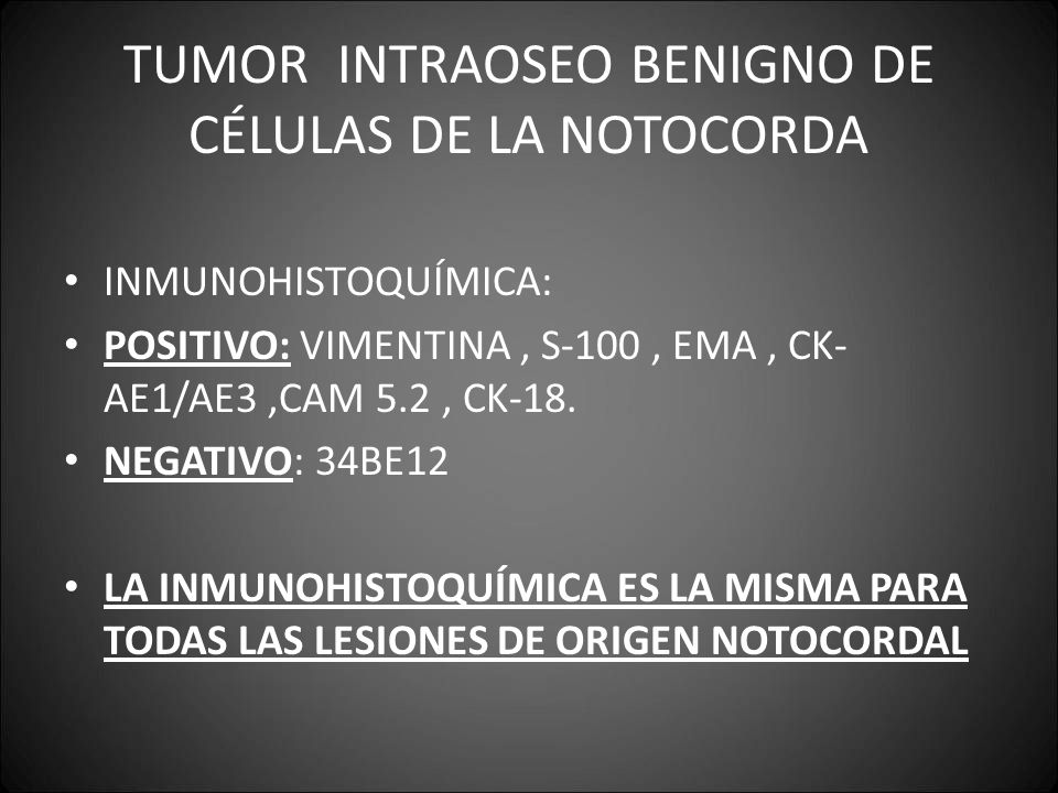 TUMOR INTRAOSEO BENIGNO DE CÉLULAS DE LA NOTOCORDA