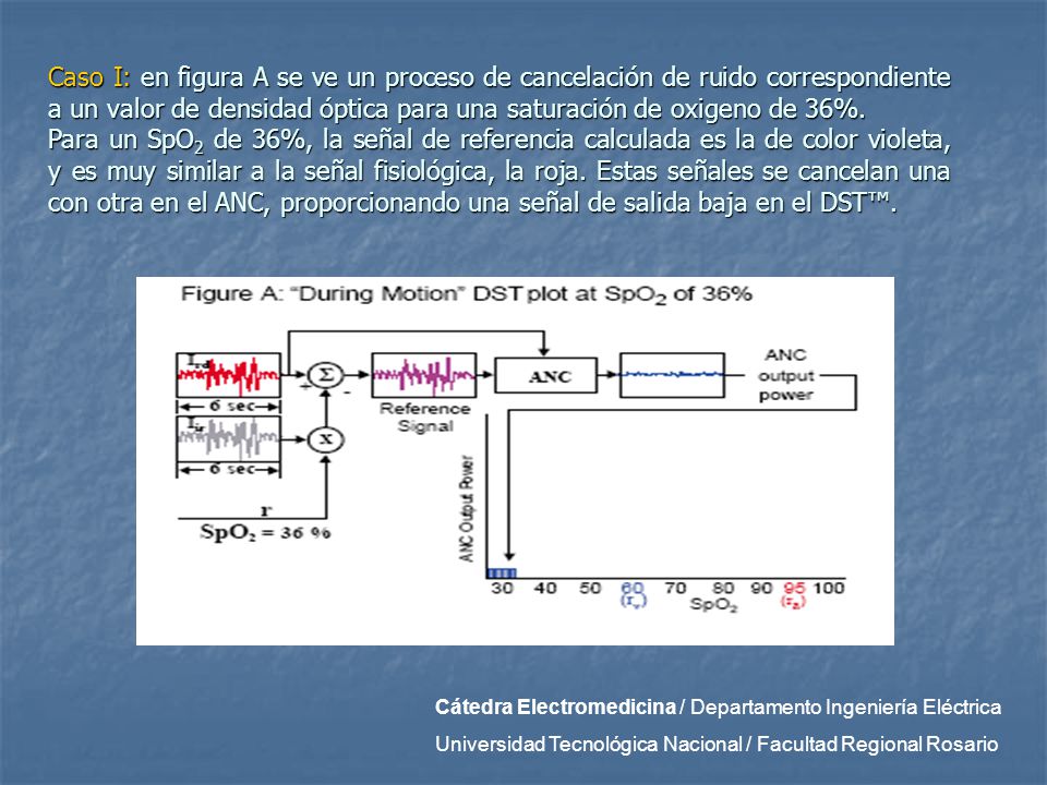 Caso I: en figura A se ve un proceso de cancelación de ruido correspondiente a un valor de densidad óptica para una saturación de oxigeno de 36%.