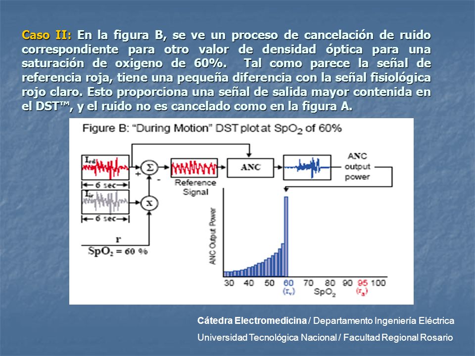 Caso II: En la figura B, se ve un proceso de cancelación de ruido correspondiente para otro valor de densidad óptica para una saturación de oxigeno de 60%. Tal como parece la señal de referencia roja, tiene una pequeña diferencia con la señal fisiológica rojo claro. Esto proporciona una señal de salida mayor contenida en el DST™, y el ruido no es cancelado como en la figura A.