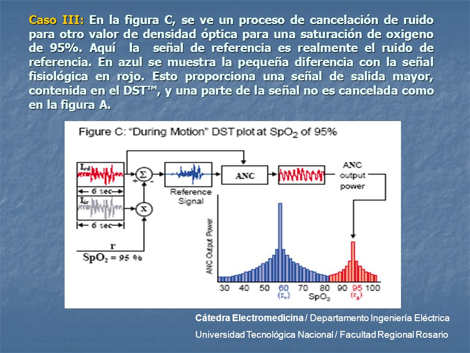 Caso III: En la figura C, se ve un proceso de cancelación de ruido para otro valor de densidad óptica para una saturación de oxigeno de 95%. Aquí la señal de referencia es realmente el ruido de referencia. En azul se muestra la pequeña diferencia con la señal fisiológica en rojo. Esto proporciona una señal de salida mayor, contenida en el DST™, y una parte de la señal no es cancelada como en la figura A.