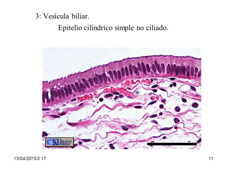 3: Vesícula biliar. Epitelio cilíndrico simple no ciliado.
