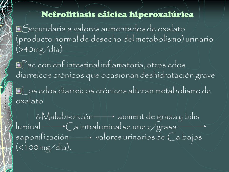 Nefrolitiasis cálcica hiperoxalúrica