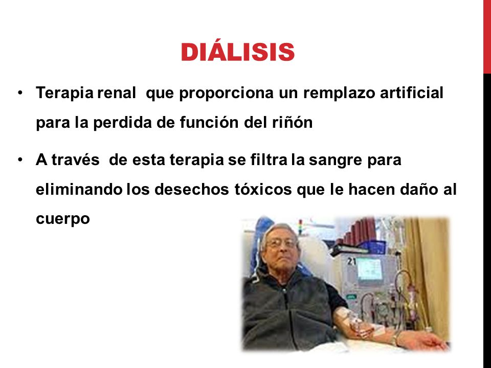 Diálisis Terapia renal que proporciona un remplazo artificial para la perdida de función del riñón.