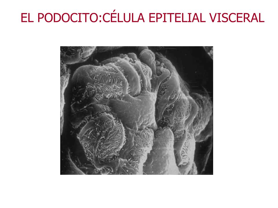 EL PODOCITO:CÉLULA EPITELIAL VISCERAL