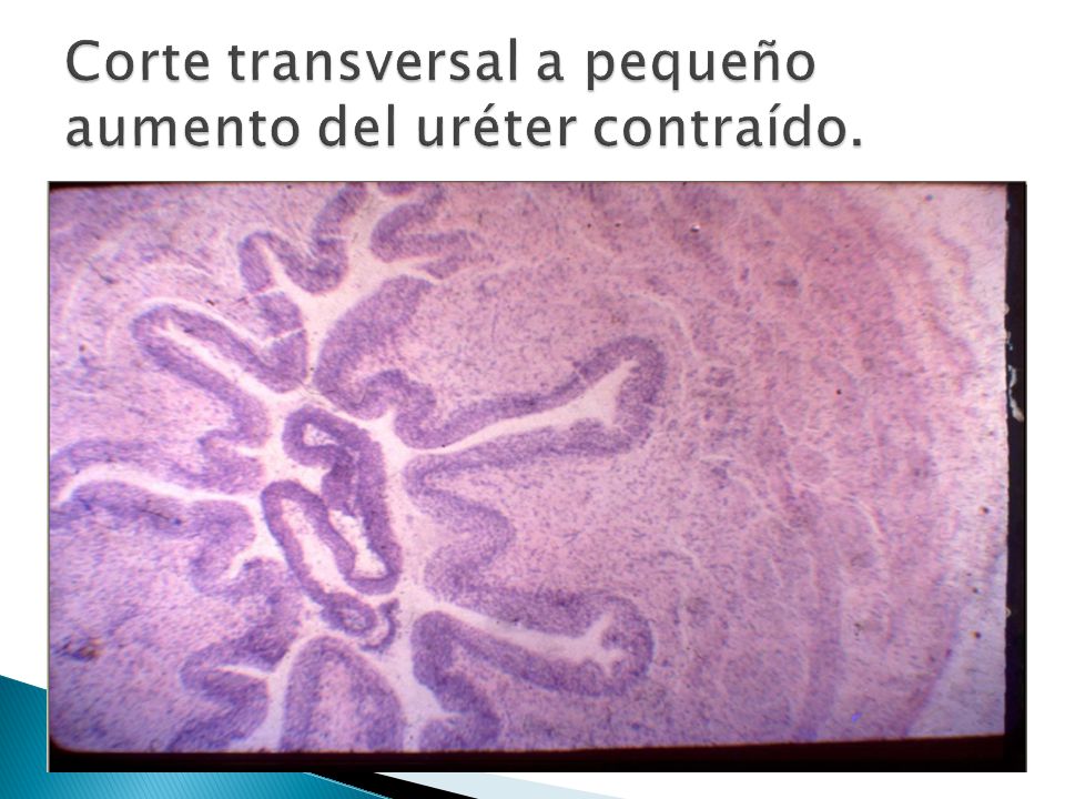 Corte transversal a pequeño aumento del uréter contraído.