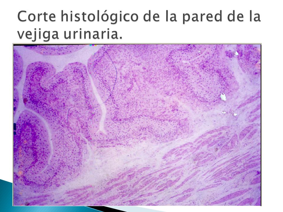 Corte histológico de la pared de la vejiga urinaria.