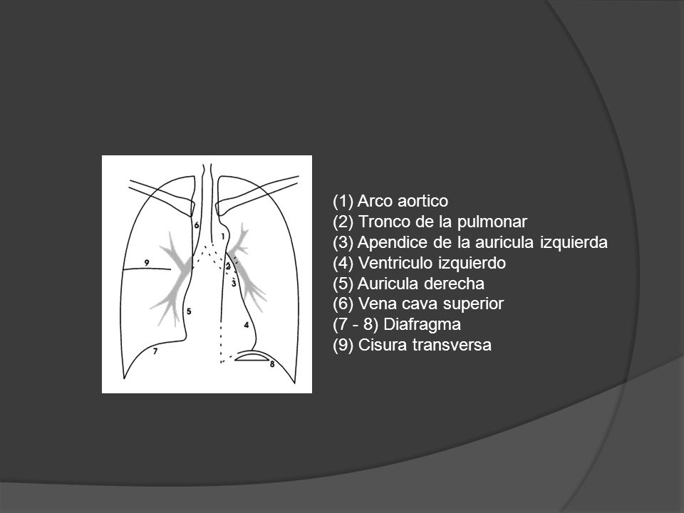 (1) Arco aortico (2) Tronco de la pulmonar. (3) Apendice de la auricula izquierda. (4) Ventriculo izquierdo.