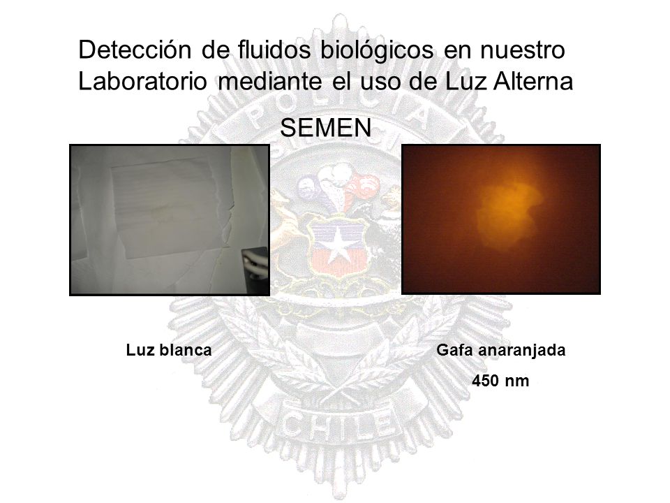 Detección de fluidos biológicos en nuestro Laboratorio mediante el uso de Luz Alterna