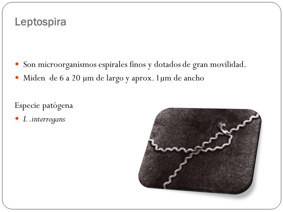 Leptospira Son microorganismos espirales finos y dotados de gran movilidad. Miden de 6 a 20 µm de largo y aprox. 1µm de ancho.