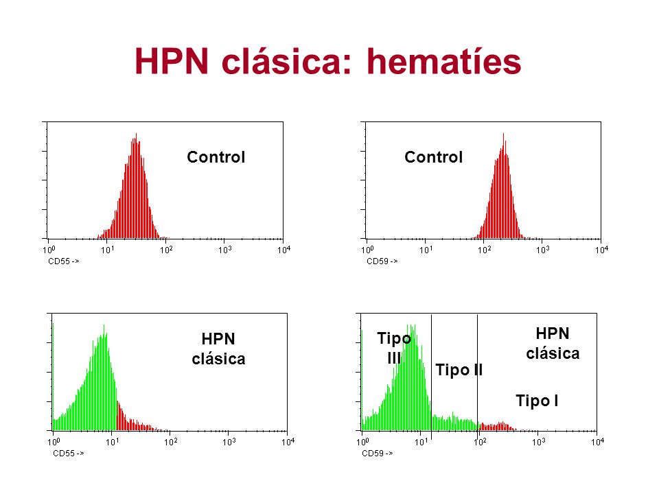 HPN clásica: hematíes Control Control HPN clásica HPN clásica Tipo III
